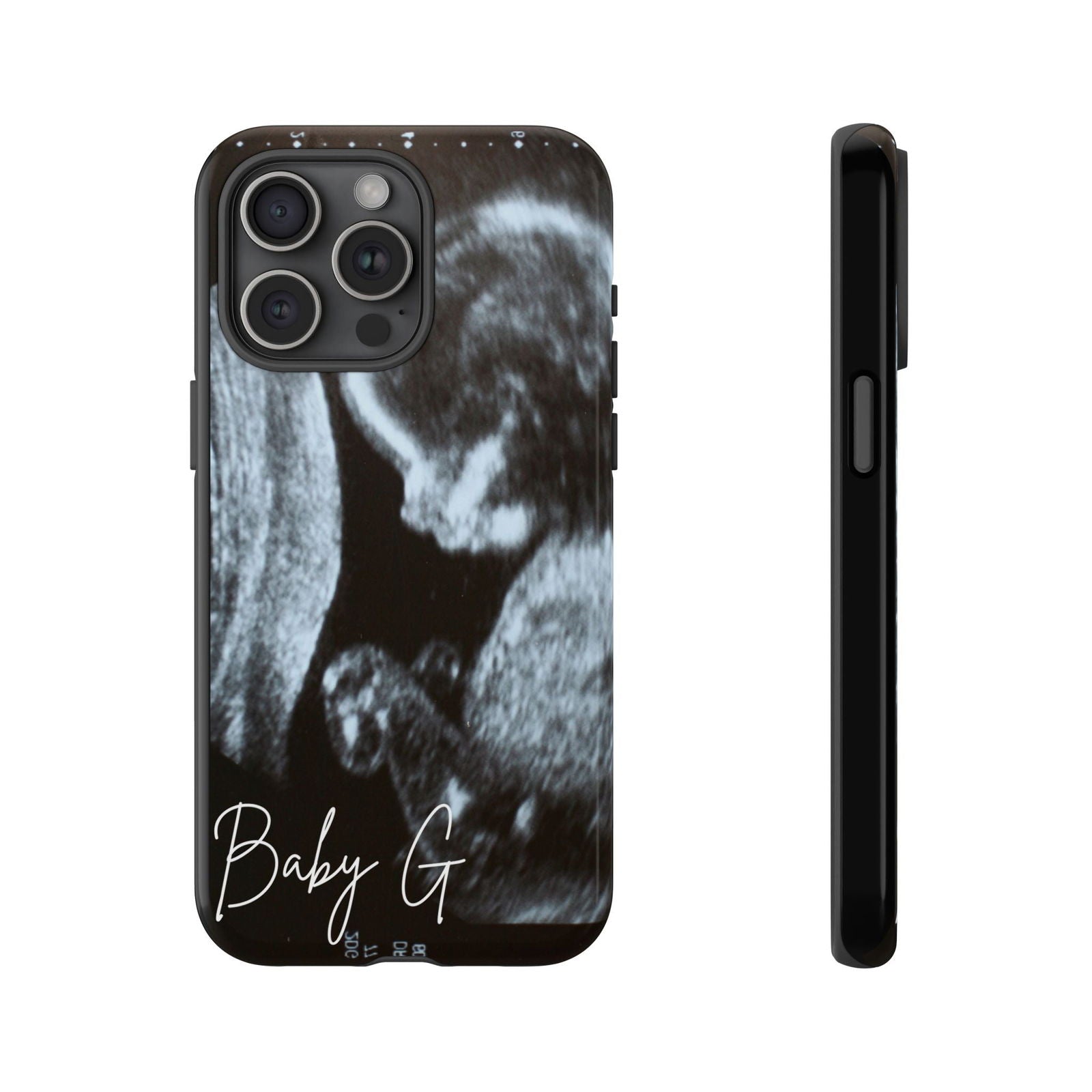 Personalized Ultrasound Phone Case - Techy Treasures - Phone Case 