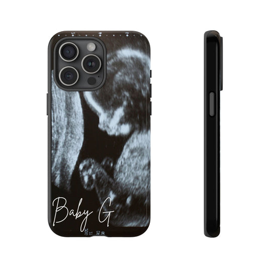 Personalized Ultrasound Phone Case - Techy Treasures - Phone Case 